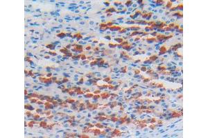 Used in DAB staining on fromalin fixed paraffin- embedded stomach tissue (LOXL2 Antikörper  (AA 553-761))