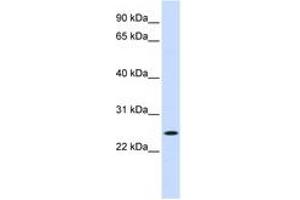Image no. 1 for anti-Nucleolar Protein 3 (Apoptosis Repressor with CARD Domain) (NOL3) (C-Term) antibody (ABIN6744368) (NOL3 Antikörper  (C-Term))