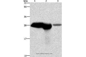 Western blot analysis of Mouse brain and kidney tissue, human fetal brain tissue, using CALB1 Polyclonal Antibody at dilution of 1:750 (CALB1 Antikörper)