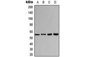 Western blot analysis of CHRNA1 expression in HeLa (A), MCF7 (B), mouse kidney (C), rat liver (D) whole cell lysates. (CHRNA1 Antikörper  (Center))