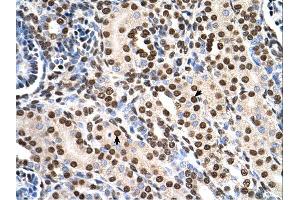 Immunohistochemistry (IHC) image for anti-Ras Suppressor Protein 1 (RSU1) (C-Term) antibody (ABIN2783331) (RSU1 Antikörper  (C-Term))