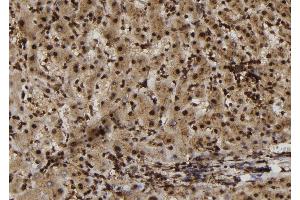 ABIN6272981 at 1/100 staining Human liver tissue by IHC-P.