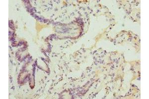 Immunohistochemistry of paraffin-embedded human lung tissue using ABIN7144880 at dilution of 1:100 (ABCA3 Antikörper  (AA 43-203))