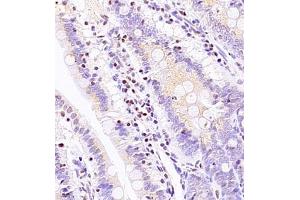 Immunohistochemistry of paraffin embedded rat ileum using ASBT (ABIN7075648) at dilution of 1:1500 (400x lens) (SLC10A2 Antikörper)