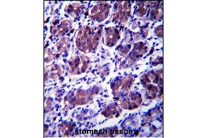 CCDC22 Antibody (C-term) (ABIN657403 and ABIN2846443) immunohistochemistry analysis in formalin fixed and paraffin embedded human stomach tissue followed by peroxidase conjugation of the secondary antibody and DAB staining. (CCDC22 Antikörper  (C-Term))