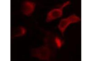ABIN6275002 staining MCF7 cells by IF/ICC.