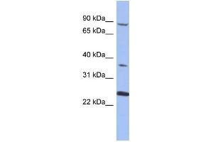 Western Blotting (WB) image for anti-Membrane Protein, Palmitoylated 3 (MAGUK P55 Subfamily Member 3) (MPP3) (N-Term) antibody (ABIN2786645)