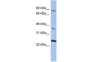 WB Suggested Anti-MPP3 Antibody Titration: 0. (MPP3 Antikörper  (N-Term))