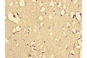 Immunohistochemistry of paraffin-embedded human brain tissue using ABIN7151461 at dilution of 1:100 (EHD3 Antikörper  (AA 269-498))