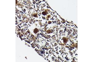 Immunohistochemistry of paraffin-embedded rat bone marrow using CXCL4/PF4 Rabbit pAb (ABIN7269400) at dilution of 1:50 (40x lens). (PF4 Antikörper)