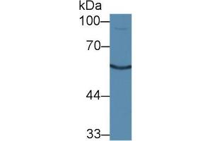 Western blot analysis of Mouse Kidney lysate, using Mouse CTR Antibody (1 µg/ml) and HRP-conjugated Goat Anti-Rabbit antibody ( (Calcitonin Receptor Antikörper  (AA 42-170))
