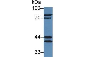 Western Blotting (WB) image for anti-Acid Phosphatase, Prostate (ACPP) (AA 56-215) antibody (ABIN7438529)