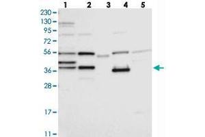 Western blot analysis of Lane 1: RT-4, Lane 2: U-251 MG, Lane 3: Human Plasma, Lane 4: Liver, Lane 5: Tonsil with ZCWPW2 polyclonal antibody . (ZCWPW2 Antikörper)
