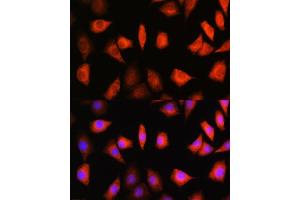 Immunofluorescence analysis of L929 cells using KIF Rabbit pAb (ABIN1680591, ABIN3019005, ABIN3019006 and ABIN6220670) at dilution of 1:100. (KIFAP3 Antikörper  (AA 1-200))