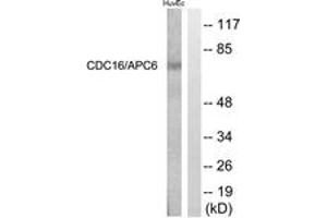 Western blot analysis of extracts from HuvEc cells, using CDC16/APC6 (Ab-560) Antibody. (CDC16 Antikörper  (AA 526-575))
