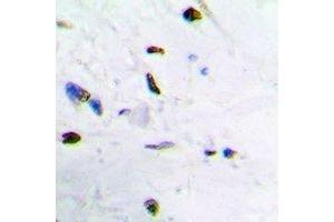 Immunohistochemical analysis of ZNF307 staining in human brain formalin fixed paraffin embedded tissue section. (ZKSCAN4 Antikörper)