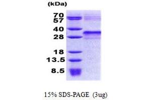 SDS-PAGE (SDS) image for Insulin-Like Growth Factor Binding Protein 6 (IGFBP6) (AA 28-240) protein (His tag) (ABIN6387264)