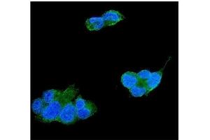 anti-TIMP Metallopeptidase Inhibitor 4 (TIMP4) (AA 174-224) antibody
