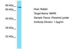 MAP6 antibody  (AA 360-409)
