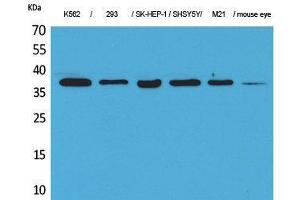 Western Blotting (WB) image for anti-Ribosomal RNA Processing 7 Homolog A (RRP7A) (C-Term) antibody (ABIN3178144) (RRP7A Antikörper  (C-Term))