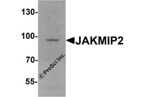 Western Blotting (WB) image for anti-Janus Kinase and Microtubule Interacting Protein 2 (JAKMIP2) antibody (ABIN1077420) (JAKMIP2 Antikörper)