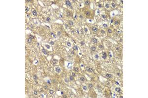 Immunohistochemistry of paraffin-embedded human liver injury using MYBPC2 antibody (ABIN6291568) at dilution of 1:100 (40x lens). (MYBPC2 Antikörper)