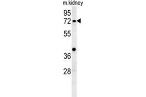 Western Blotting (WB) image for anti-Kelch-Like 6 (KLHL6) antibody (ABIN3002443) (KLHL6 Antikörper)
