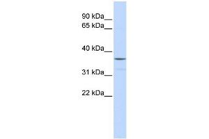 WB Suggested Anti-ZNF787 Antibody Titration:  0. (ZNF787 Antikörper  (Middle Region))