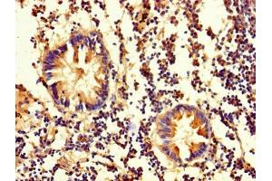 Immunohistochemistry of paraffin-embedded human appendix tissue using ABIN7162111 at dilution of 1:100 (OLA1 Antikörper  (AA 1-396))
