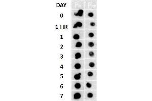 Dot blot analysis using Rabbit Anti-Amyloid Fibrils (OC) Polyclonal Antibody . (Amyloid Antikörper (Biotin))