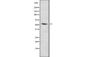 Western blot analysis of DMRTA1 using HT-29 whole cell lysates (DMRTA1 Antikörper  (Internal Region))