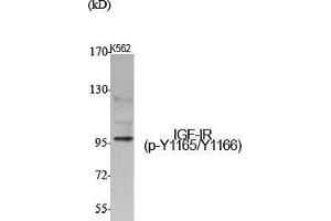 Western Blot (WB) analysis of specific cells using Phospho-IGF-IR (Y1165/Y1166) Polyclonal Antibody.