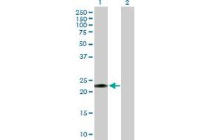 Western Blot analysis of GLIPR1L1 expression in transfected 293T cell line by GLIPR1L1 MaxPab polyclonal antibody. (GLIPR1L1 Antikörper  (AA 1-233))