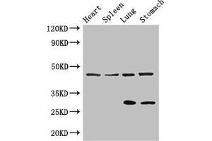 Western Blot Positive WB detected in: Mouse heart tissue, Mouse spleen tissue, Mouse lung tissue, Mouse stomach tissue All lanes: REN antibody at 3 μg/mL Secondary Goat polyclonal to rabbit IgG at 1/50000 dilution Predicted band size: 46, 45 kDa Observed band size: 46, 29 kDa (Renin Antikörper  (AA 229-398))