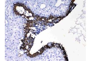 IHC analysis of Cytokeratin 8 using anti- Cytokeratin 8 antibody . (KRT8 Antikörper  (AA 107-325))