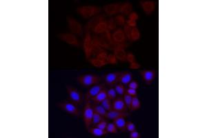 Immunofluorescence analysis of HeLa using Vinculin Rabbit mAb (ABIN3016604, ABIN3016605, ABIN1680530 and ABIN1680531) at dilution of 1:100 (40x lens). (Vinculin Antikörper)