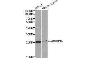 Western blot analysis of extracts of various cell lines, using ARHGDIA antibody (ABIN6291256) at 1:1000 dilution. (ARHGDIA Antikörper)