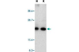 Western blot analysis of CRADD in whole cell lysates from HeLa (H) or K-562 (K) cells with CRADD polyclonal antibody  at 1 : 500 dilution. (CRADD Antikörper  (AA 99-117))