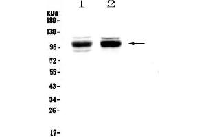 Western blot analysis of SATB1 using anti-SATB1 antibody .