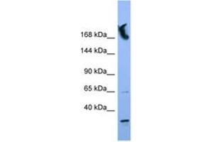 Image no. 1 for anti-Nucleoporin 155kDa (NUP155) (N-Term) antibody (ABIN6746368) (NUP155 Antikörper  (N-Term))