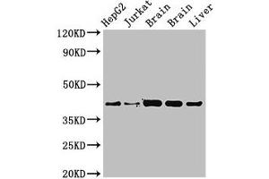 Western Blot Positive WB detected in: HepG2 whole cell lysat, Jurkat whole cell lysate, Rat brain tissue, Mouse brain tissue, Mouse liver tissue All lanes: IDH3A antibody at 3. (IDH3A Antikörper  (AA 28-108))