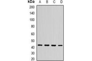 Western blot analysis of ST3GAL5 expression in BT474 (A), SHSY5Y (B), mouse brain (C), rat brain (D) whole cell lysates. (ST3GAL5 Antikörper)