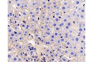 Immunohistochemistry (Paraffin-embedded Sections) (IHC (p)) image for anti-Cadherin 1, Type 1, E-Cadherin (Epithelial) (CDH1) antibody (ABIN7249790)