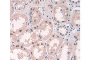 Used in DAB staining on fromalin fixed paraffin- embedded Kidney tissue (ERCC2 Antikörper  (AA 404-637))