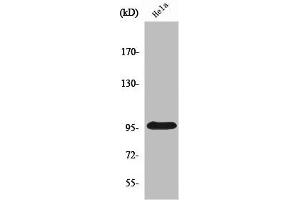 Western Blot analysis of HepG2 cells using Plakophilin 2 Polyclonal Antibody (Plakophilin 2 Antikörper  (C-Term))