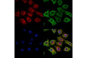 ABIN6264192 and ABIN6269201 staining HepG2 cells by IF/ICC.
