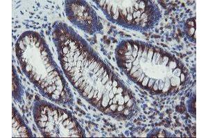 Immunohistochemical staining of paraffin-embedded Human colon tissue using anti-ACBD3 mouse monoclonal antibody. (ACBD3 Antikörper)