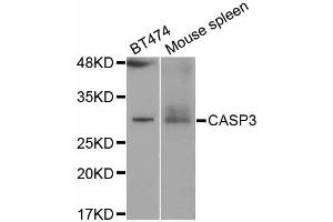 Western blot analysis of extracts of various cell lines, using CASP3 antibody (ABIN5997364) at 1/1000 dilution. (Caspase 3 Antikörper)