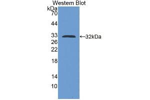 Western blot analysis of the recombinant protein. (Kallikrein 13 Antikörper  (AA 22-277))