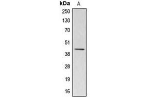 Western blot analysis of Kappa-actin expression in HuvEc (A) whole cell lysates. (ACTBL3 Antikörper  (Center))